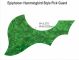Epiphone Acoustic - Green Pearl Pickguard
