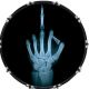 Hand Xray 1