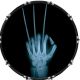 Wolverine Xray